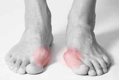 Common Disorders